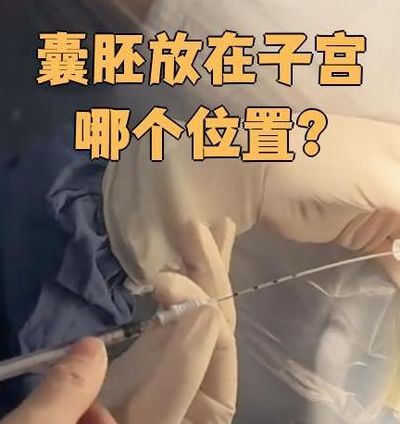 没子宫的人可以做试管吗女性？能卵母细胞采集不等于能怀孕