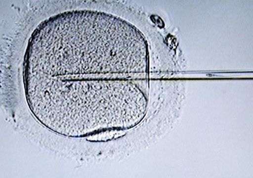 试管婴儿医疗保险报销吗？我花5万换来的真实经验