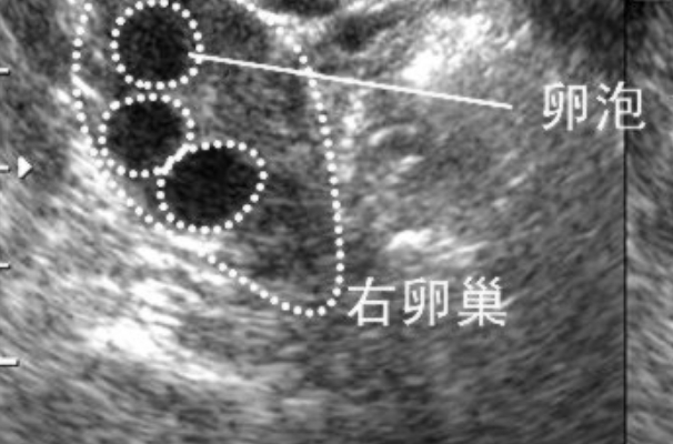 右侧卵泡怀孕不一定怀的男孩