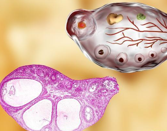 卵泡雌激素高影响卵巢功能
