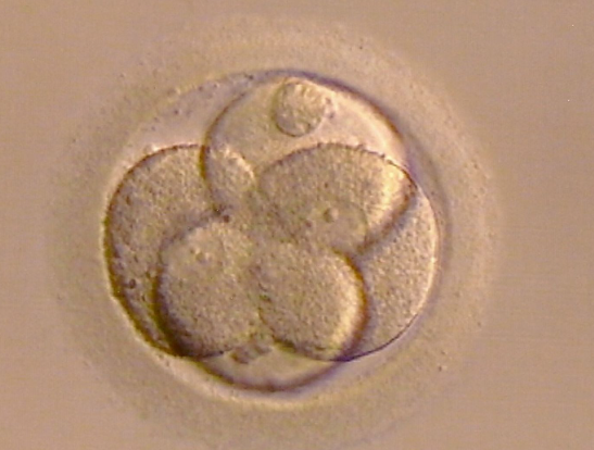 胚胎质量不佳易着床失败