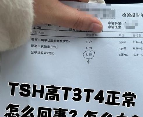 备孕TSH必须低于2.5吗？先查这项指标，再决定吃不吃药