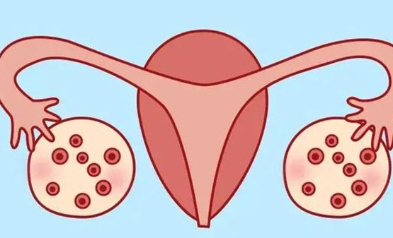 卵巢是女性生殖系统的重要组成部分