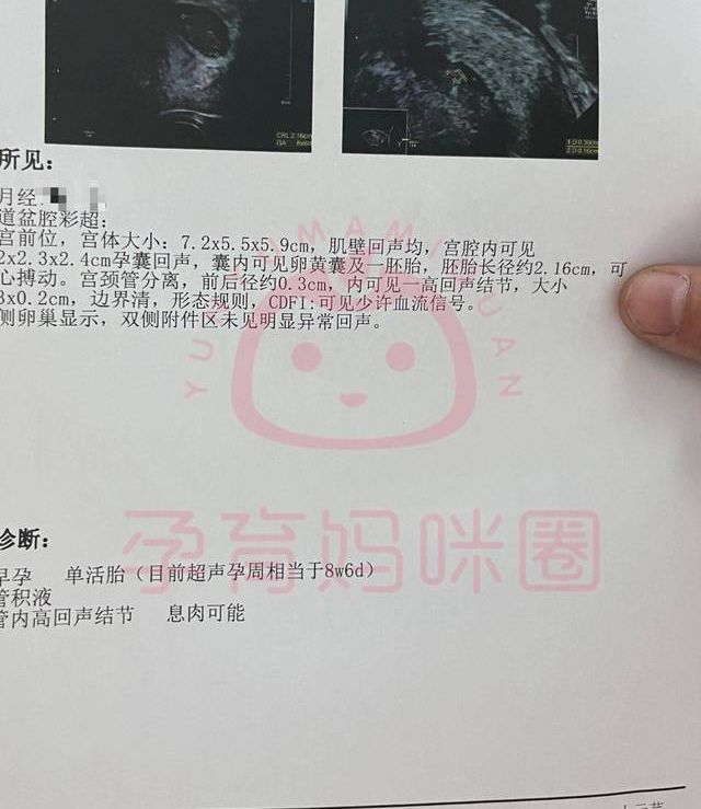 NT 单上的 nub 值怎么看男女？B 超医生不说但你能懂的角度判断法