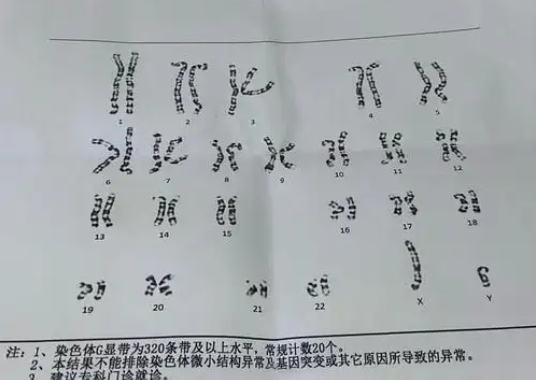 染色体有问题可以做三代试管