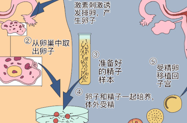 促排方案会影响试管进周时间
