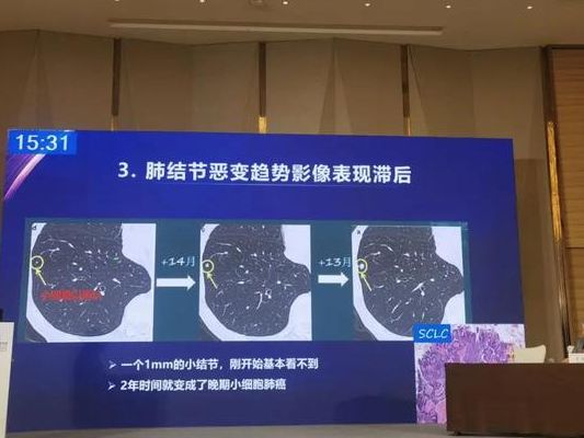 七周验血女孩容易出错，挑机构前先过这4个判断维度