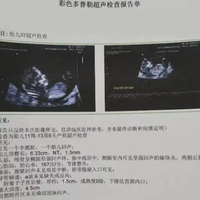 NT检查能看出胎儿是男孩还是女孩吗？专业解答来了