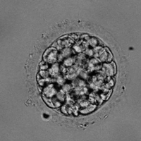 试管移植二级胚胎是不是会比囊胚着床慢？