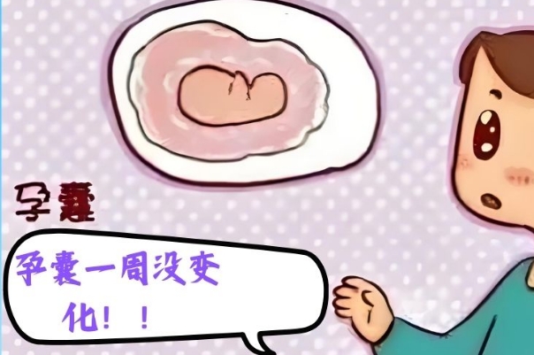 排出来的孕囊可见粉白色组织
