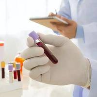 验血太早Y染色体为啥测不出来?这背后的真相你得懂！