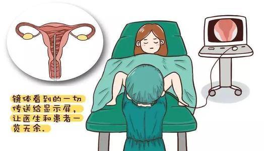 宫腹腔镜手术后多久可以怀孕