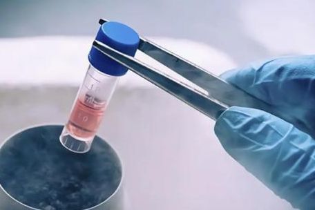 ivm是几代试管？它其实不算常规第几代