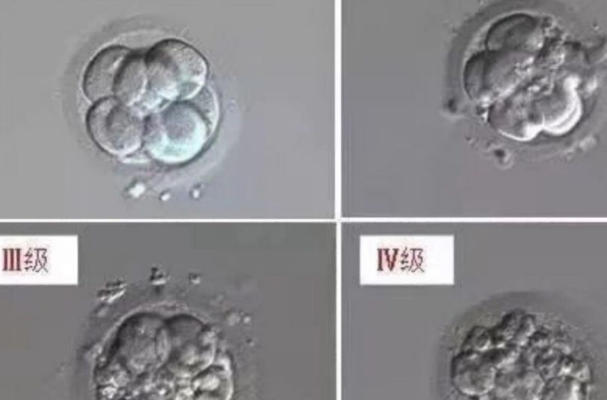 胚胎外观会影响等级评定