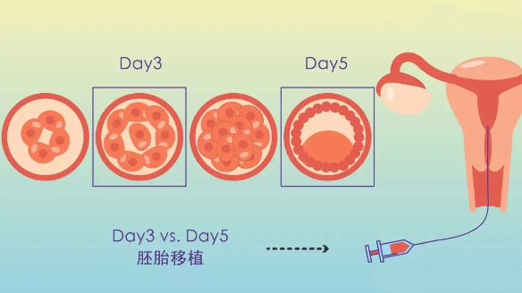 试管移植囊胚12天白板验血成功，是代表怀孕吗？