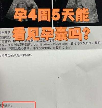 孕囊长了但是看不到胎心胎芽，试管移植后我经历了最难熬的一周