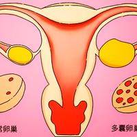 多囊食谱月减16斤,多囊姐妹必看!