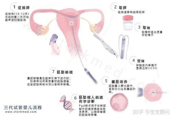 什么是第四代试管婴儿？线粒体置换技术真能解决卵子老化吗