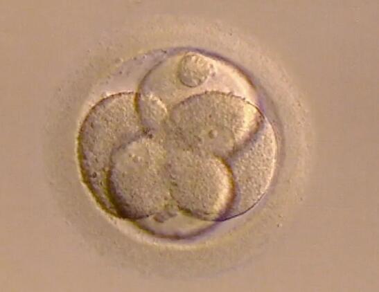 胚胎治疗会决定移植着床率