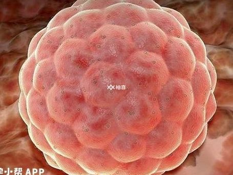 取卵后第二天可以上班吗？看你的获卵数和工作类型再决定
