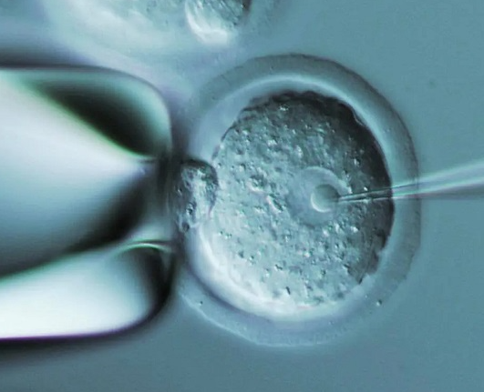 冻胚移植是常见方式