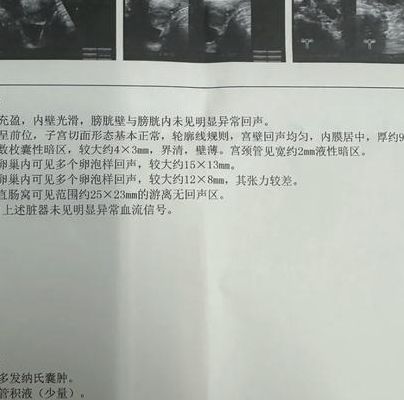 月经第三天阴超检查卵泡:查基础PK查优势,时机别选错