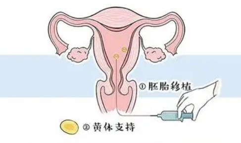 孕酮高鲜胚移植的成功率怎么样？鲜胚移植条件