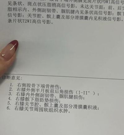 1粒布洛芬会使胚胎畸形么？查出怀孕那一刻我悔得发抖