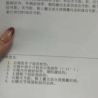 1粒布洛芬会使胚胎畸形么？查出怀孕那一刻我悔得发抖