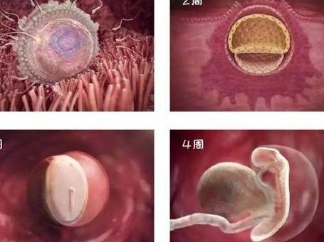 设计试管婴儿与试管婴儿的区别是什么：前者选胚胎，后者只助孕