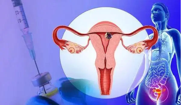 子宫切除保留卵巢影响更年期