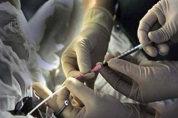 做试管婴儿可以挂生殖医学科