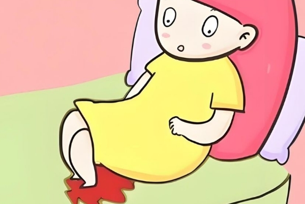 孕13周nt正常但突然流血可能是宫颈原因