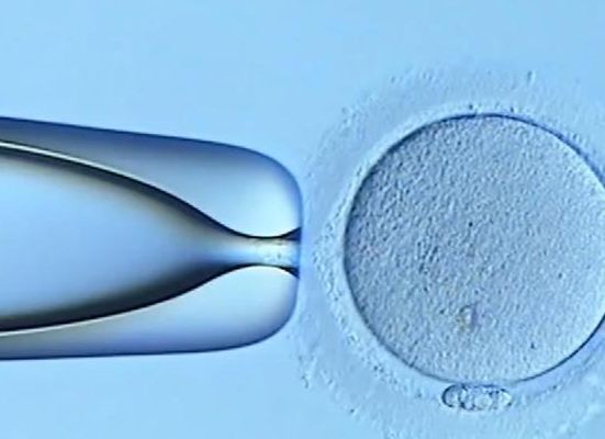 17周看男孩女孩诀窍：三代试管多少钱？过来人帮你梳理6笔开销明细
