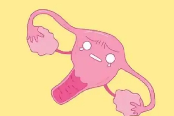 弓形子宫作为一种轻度子宫畸形