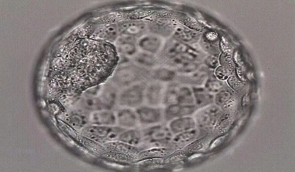 移植5天囊胚相当于怀孕几周