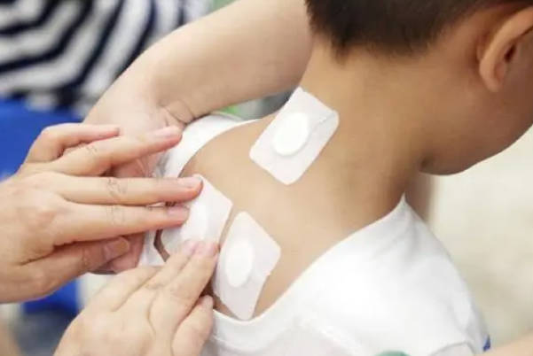 给宝宝用三伏贴贴在肺俞穴