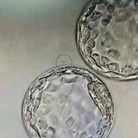 二代试管胚胎7级能移植吗？一般不会优先选择这类胚胎