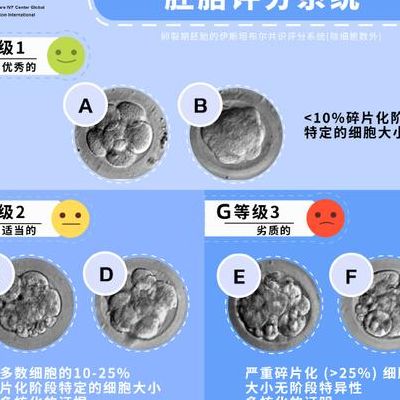 移植当天5个判断维度：胚胎安全与成功率都藏在细节里