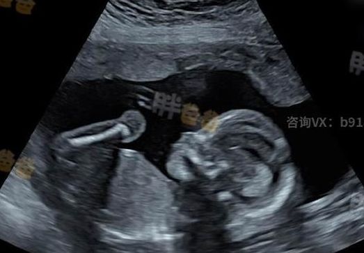东莞试管婴儿成功率较高的医院，抓住4个判断维度就够了