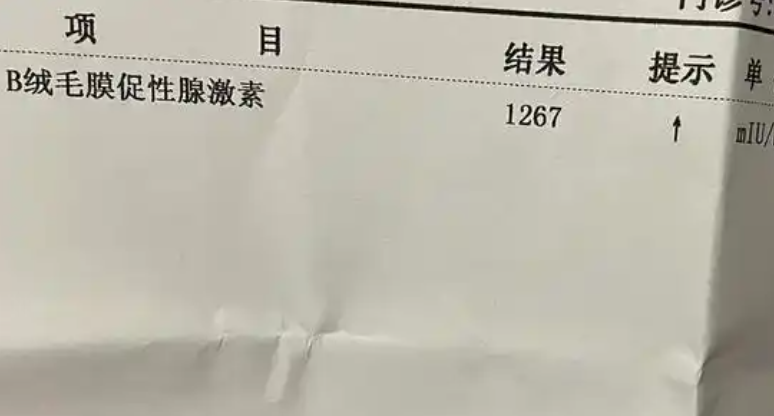 HCG不同医院结果有差异
