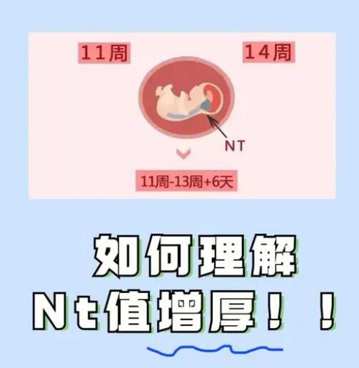 孕11-13周nt值看男女85%的准确率，相信科学力量