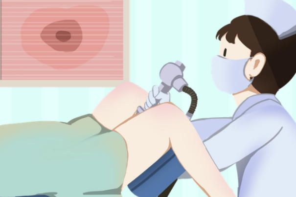 效果没看到导致宫腔灌注后悔