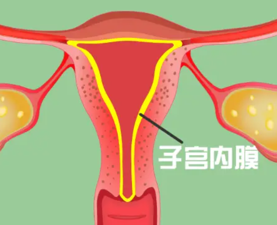 子宫内膜不好会影响生育