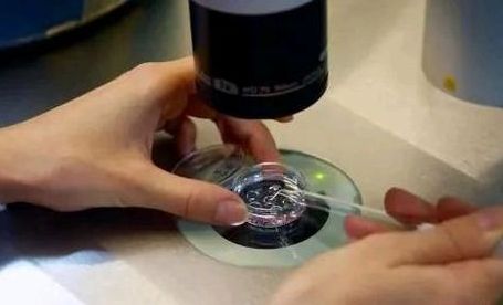 试管婴儿算不算亲生的？我移植三次才成功，说点大实话