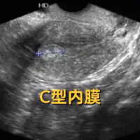 试管移植子宫内膜8c成功率高吗?移植成功率因人而异