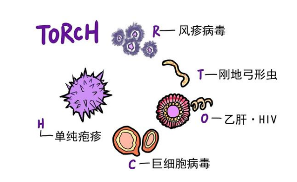 Torch优生四项检查费用