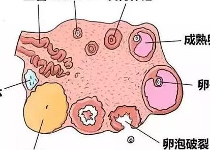 用别人的卵泡做试管费用多少？过来人帮你梳理5笔开销明细