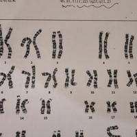 染色体异常可以做试管吗？能，但关键要做对这一步