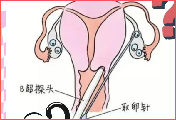 卵子数量不会直接决定<a href=